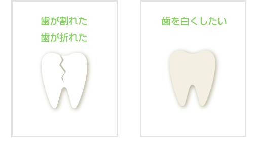 応急処置 歯が割れた 歯が折れた 歯を白くしたい