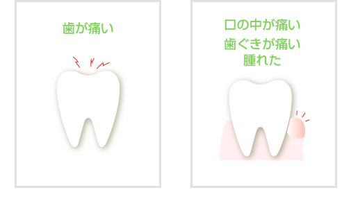 応急処置 歯が痛い 口の中が痛い 歯ぐきが痛い 腫れた