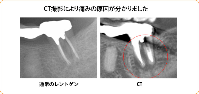 デジタルレントゲンCT