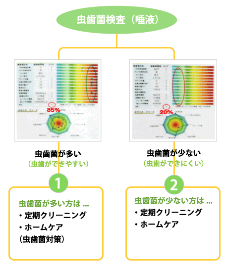 虫歯菌検査（唾液）