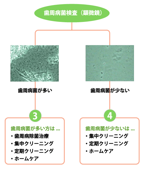 歯周病菌検査（顕微鏡）