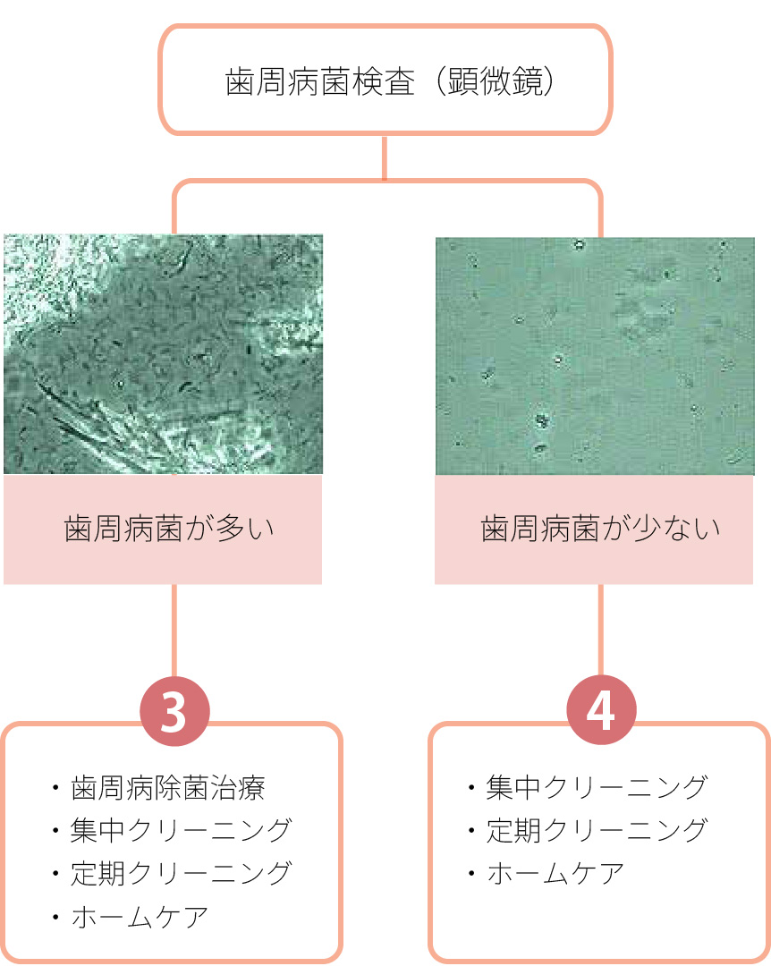 歯周病菌検査（顕微鏡）