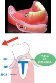 マグフィット(磁石)