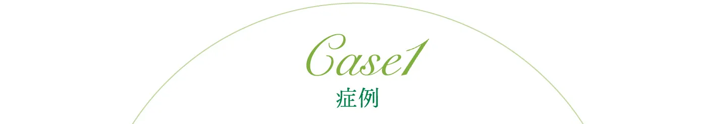 審美治療 症例1 CASE 1