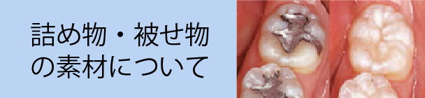 詰め物・被せ物の素材について