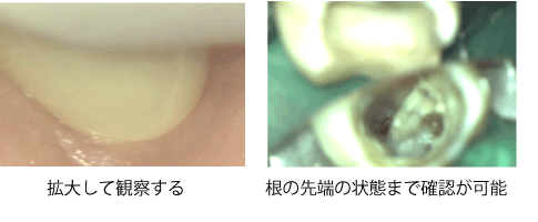 拡大して観察する,根の先端の状態まで確認が可能