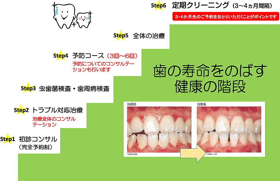 歯の寿命を延ばす