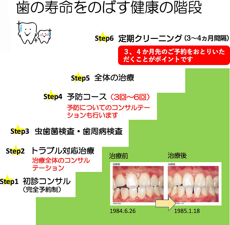歯の寿命を延ばす