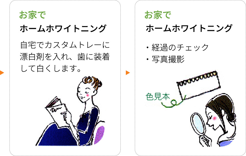 ホワイトニング
